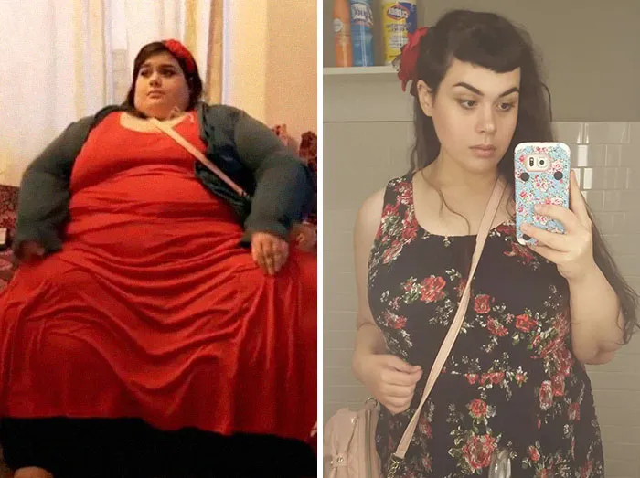 Amber Rachdi Was 660 Lbs, She Dropped To 236 Lbs