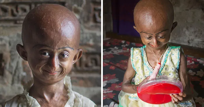 Doctors Gave This Girl 3 More Years To Live, And She's Becoming An Example On How To Enjoy Life