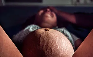 30 Elocuentes fotos del Concurso de fotografía de Nacimiento 2018 que demuestran lo fuertes que son las madres (NSFW)