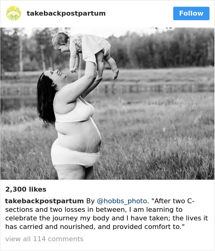 90 Brutally Honest Photos Of Post-Baby Bodies, That Women Are Sharing To Reveal The Truth No One Talks About
