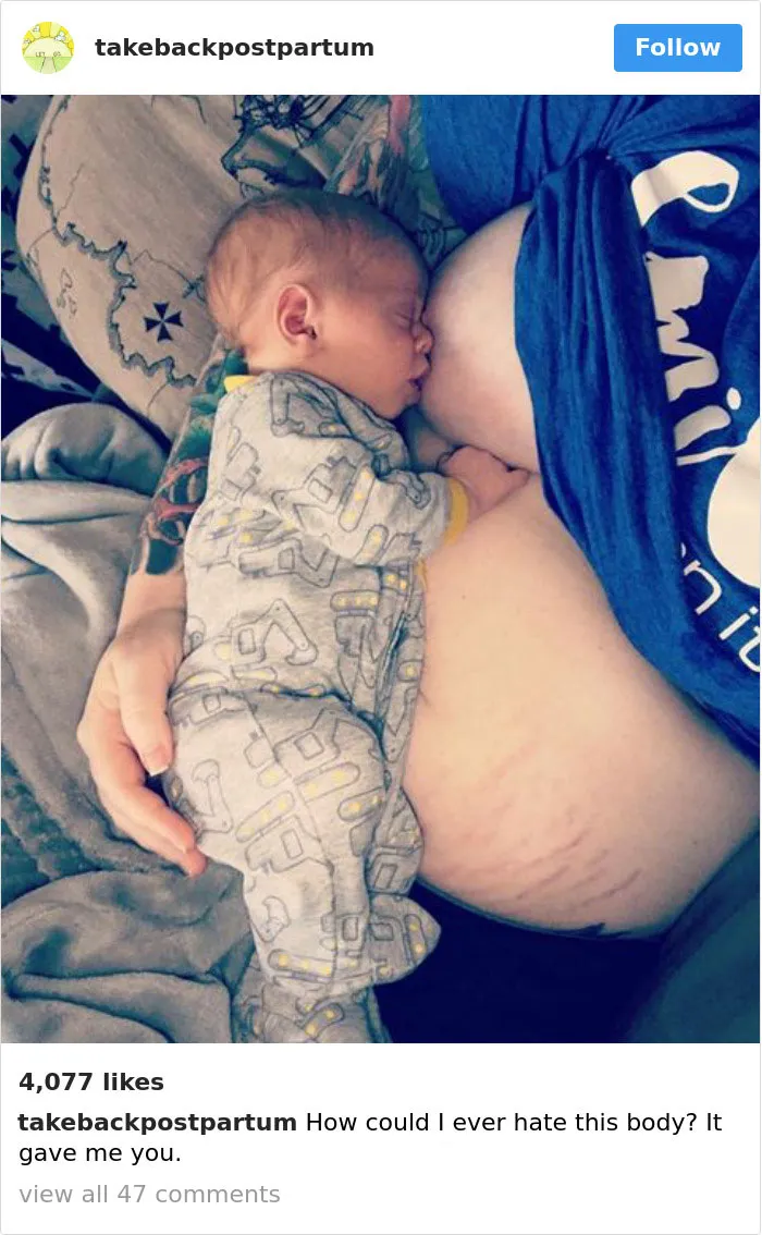 90 Brutally Honest Photos Of Post-Baby Bodies, That Women Are Sharing To Reveal The Truth No One Talks About