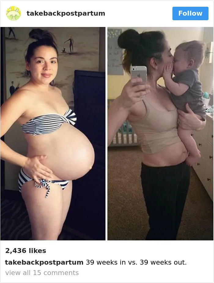 90 Brutally Honest Photos Of Post-Baby Bodies, That Women Are Sharing To Reveal The Truth No One Talks About