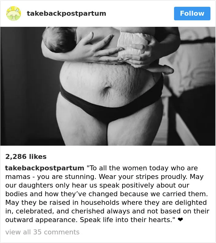 90 Brutally Honest Photos Of Post-Baby Bodies, That Women Are Sharing To Reveal The Truth No One Talks About