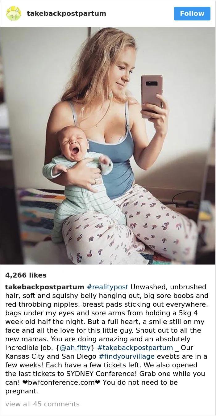 90 Brutally Honest Photos Of Post-Baby Bodies, That Women Are Sharing To Reveal The Truth No One Talks About