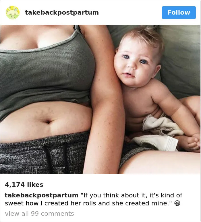 90 Brutally Honest Photos Of Post-Baby Bodies, That Women Are Sharing To Reveal The Truth No One Talks About