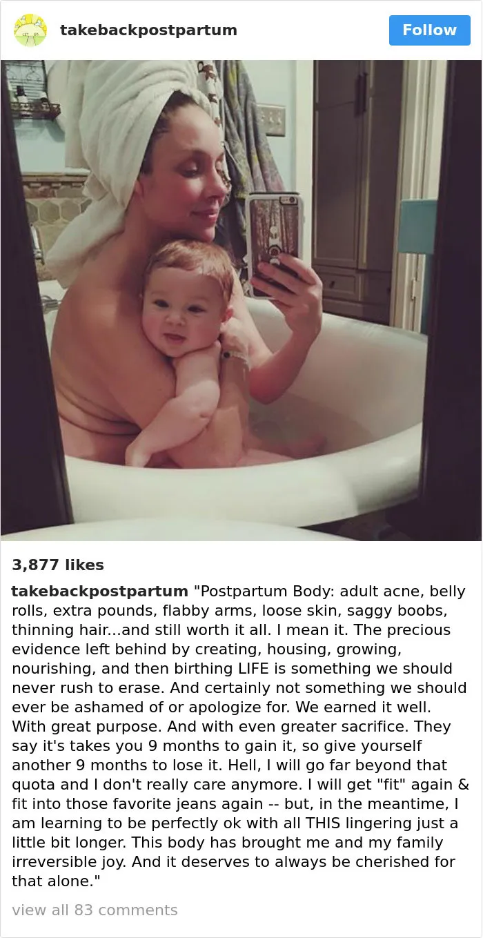 90 Brutally Honest Photos Of Post-Baby Bodies, That Women Are Sharing To Reveal The Truth No One Talks About