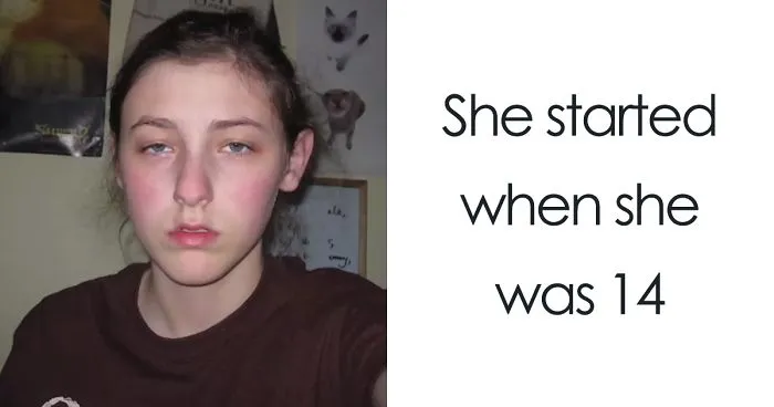 Teen Takes Selfies Every Day For 8 Years, Shows How Subtle Changes Create A Big Difference At The End