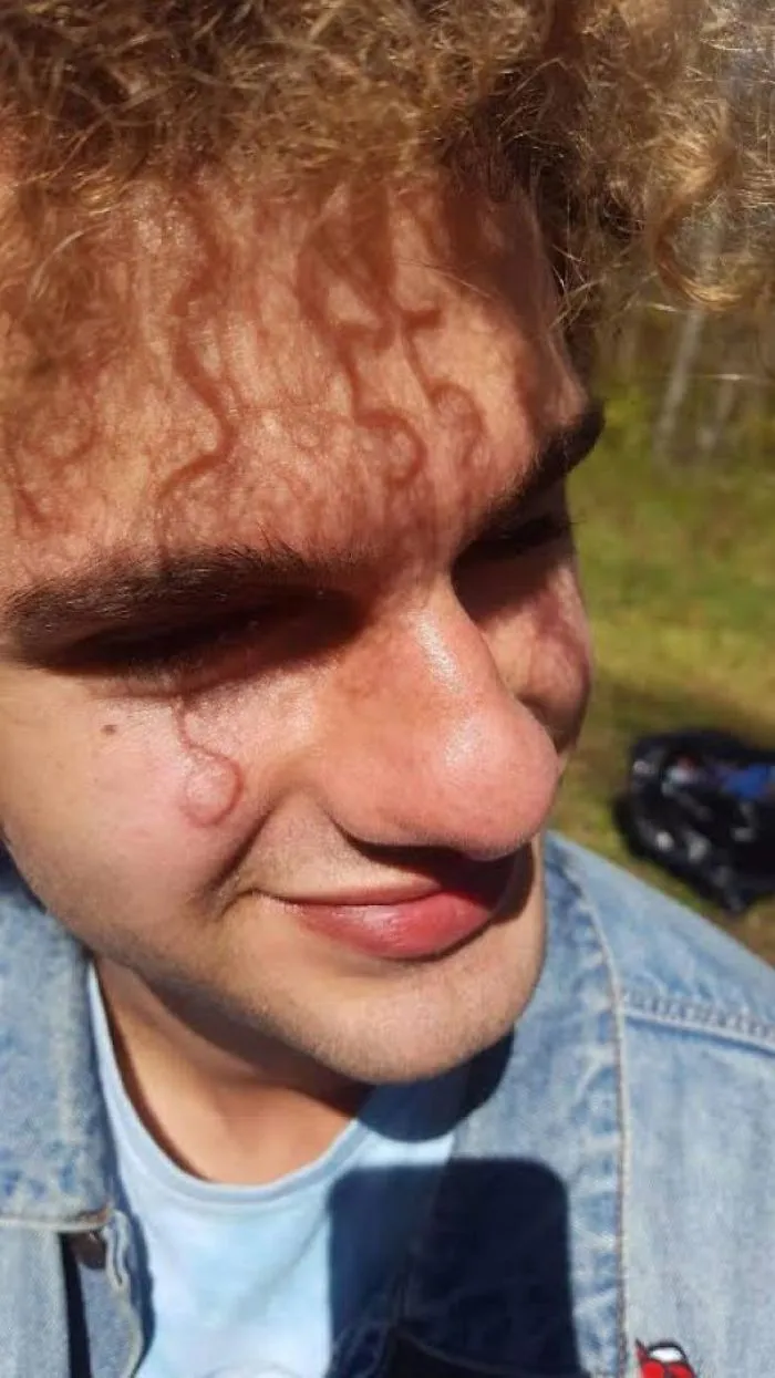 La sombra de mi pelo forma un 55