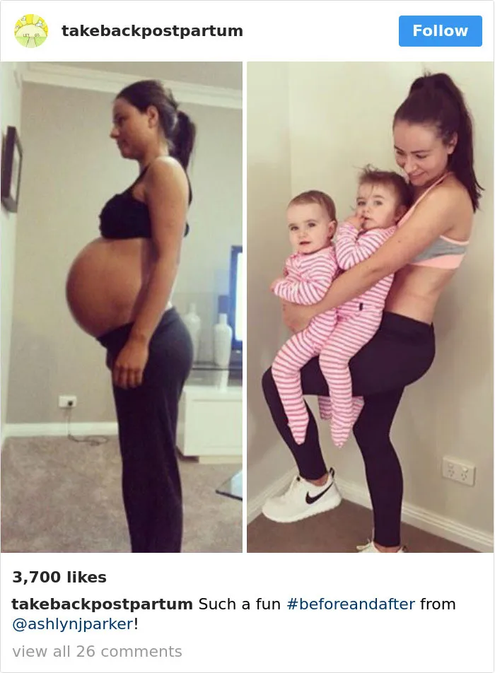 90 Brutally Honest Photos Of Post-Baby Bodies, That Women Are Sharing To Reveal The Truth No One Talks About