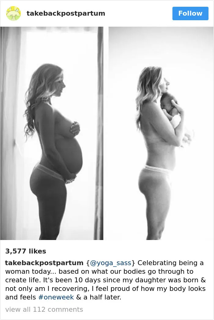 90 Brutally Honest Photos Of Post-Baby Bodies, That Women Are Sharing To Reveal The Truth No One Talks About