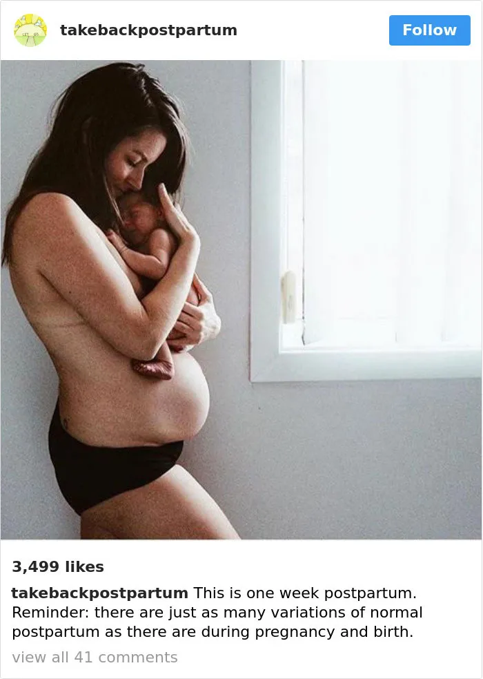 90 Brutally Honest Photos Of Post-Baby Bodies, That Women Are Sharing To Reveal The Truth No One Talks About