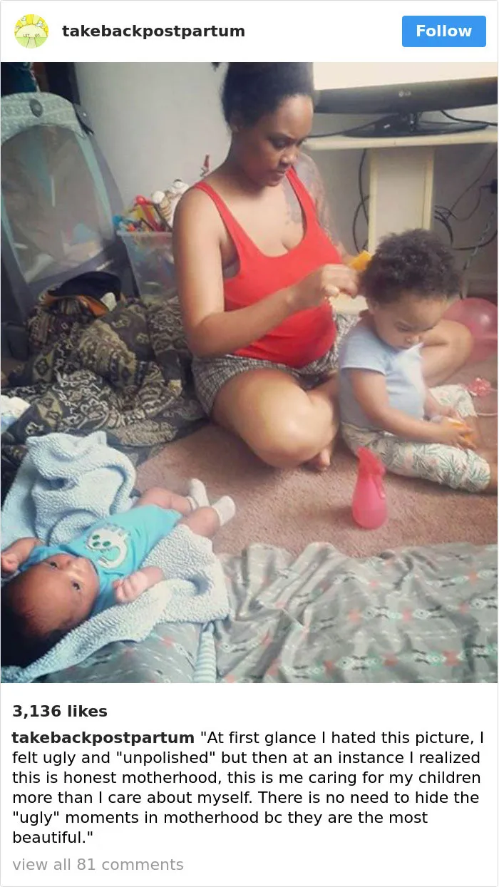 90 Brutally Honest Photos Of Post-Baby Bodies, That Women Are Sharing To Reveal The Truth No One Talks About