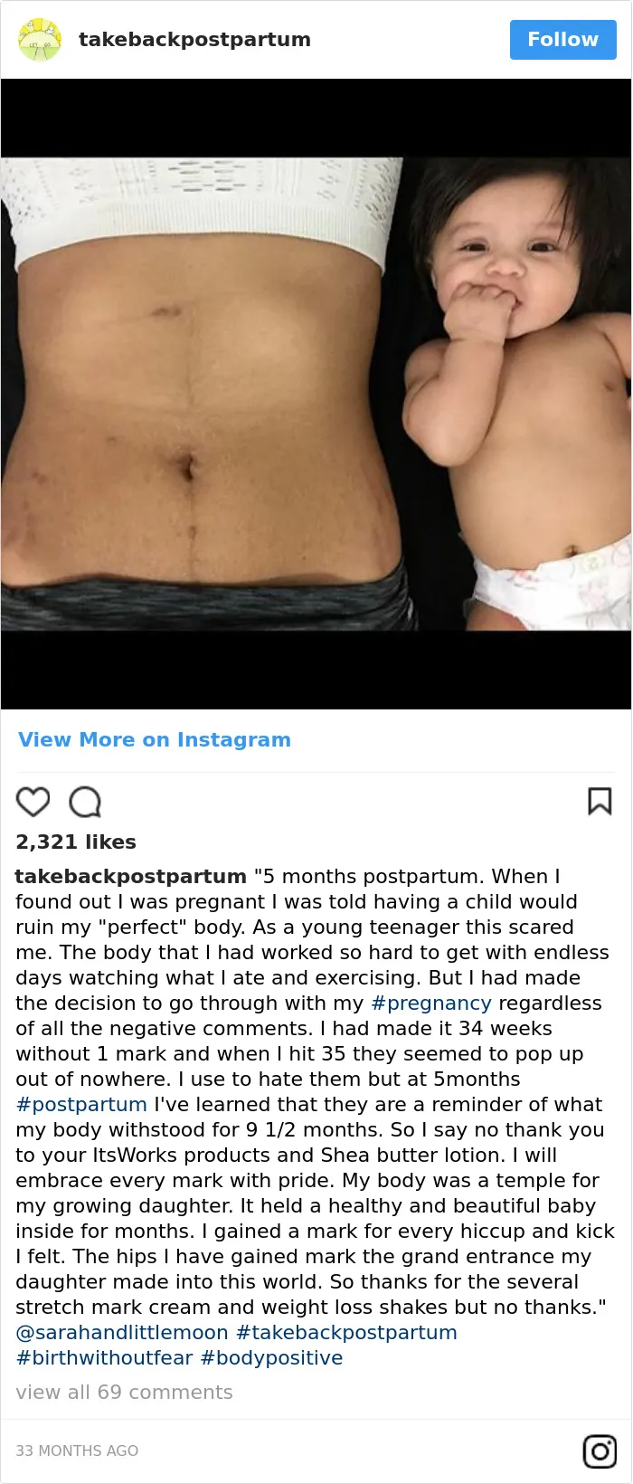 90 Brutally Honest Photos Of Post-Baby Bodies, That Women Are Sharing To Reveal The Truth No One Talks About