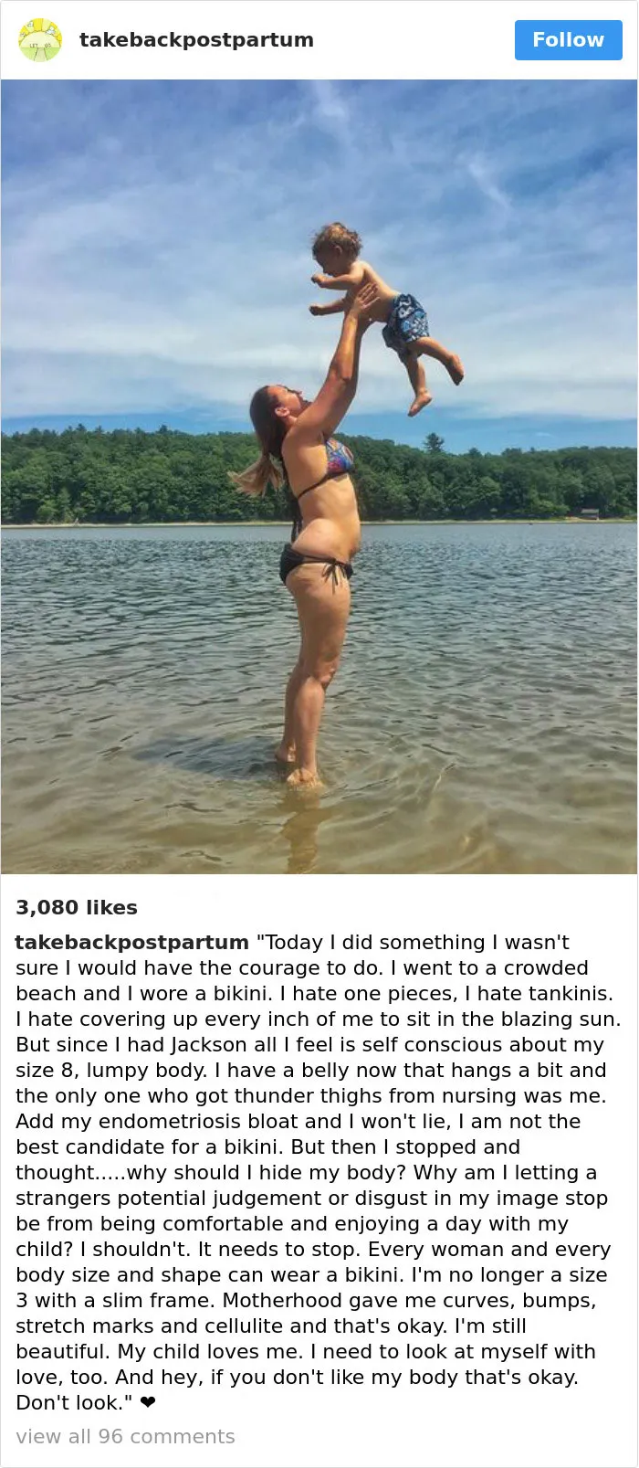 90 Brutally Honest Photos Of Post-Baby Bodies, That Women Are Sharing To Reveal The Truth No One Talks About