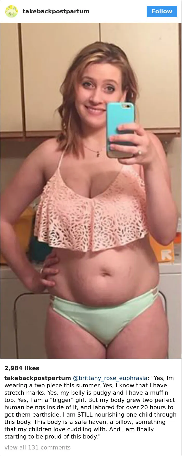 90 Brutally Honest Photos Of Post-Baby Bodies, That Women Are Sharing To Reveal The Truth No One Talks About