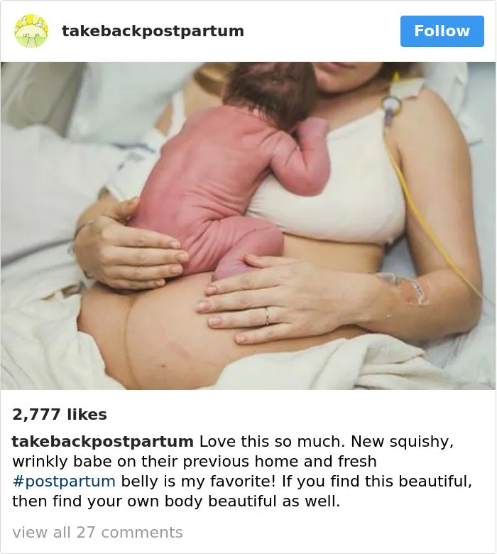 90 Brutally Honest Photos Of Post-Baby Bodies, That Women Are Sharing To Reveal The Truth No One Talks About