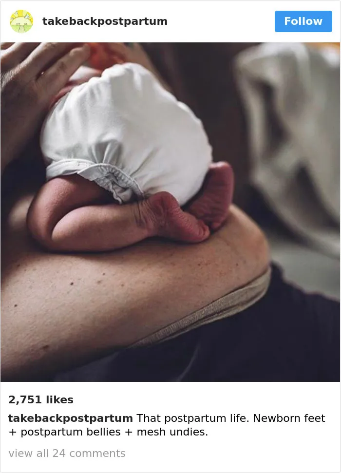 90 Brutally Honest Photos Of Post-Baby Bodies, That Women Are Sharing To Reveal The Truth No One Talks About