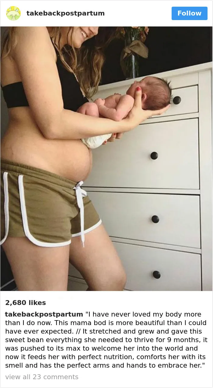 90 Brutally Honest Photos Of Post-Baby Bodies, That Women Are Sharing To Reveal The Truth No One Talks About