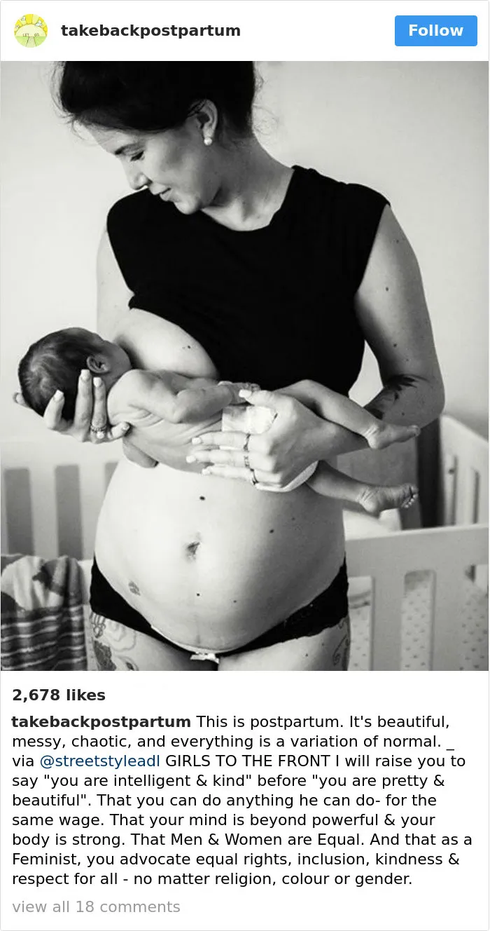 90 Brutally Honest Photos Of Post-Baby Bodies, That Women Are Sharing To Reveal The Truth No One Talks About