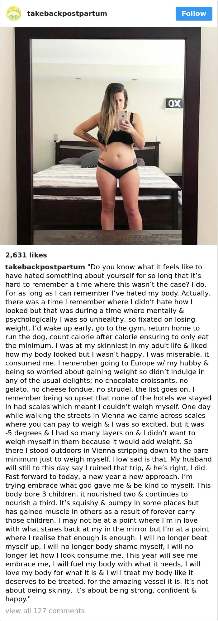 90 Brutally Honest Photos Of Post-Baby Bodies, That Women Are Sharing To Reveal The Truth No One Talks About