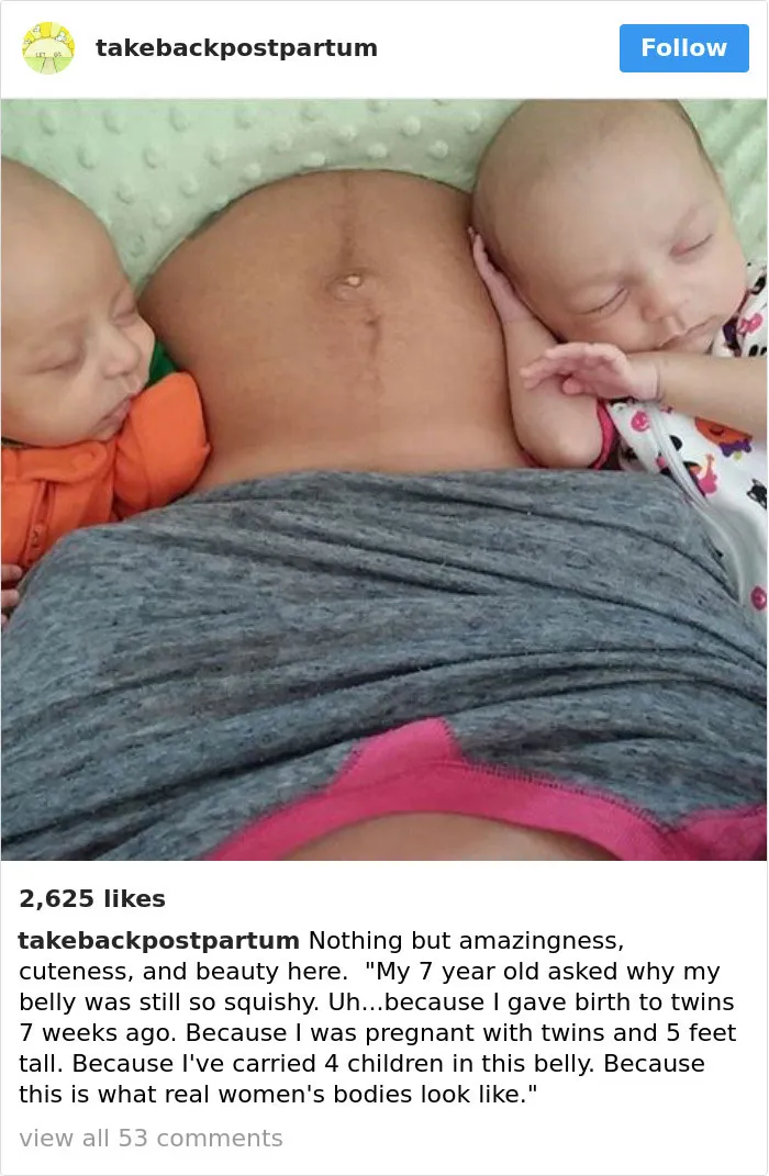 90 Brutally Honest Photos Of Post-Baby Bodies, That Women Are Sharing To Reveal The Truth No One Talks About