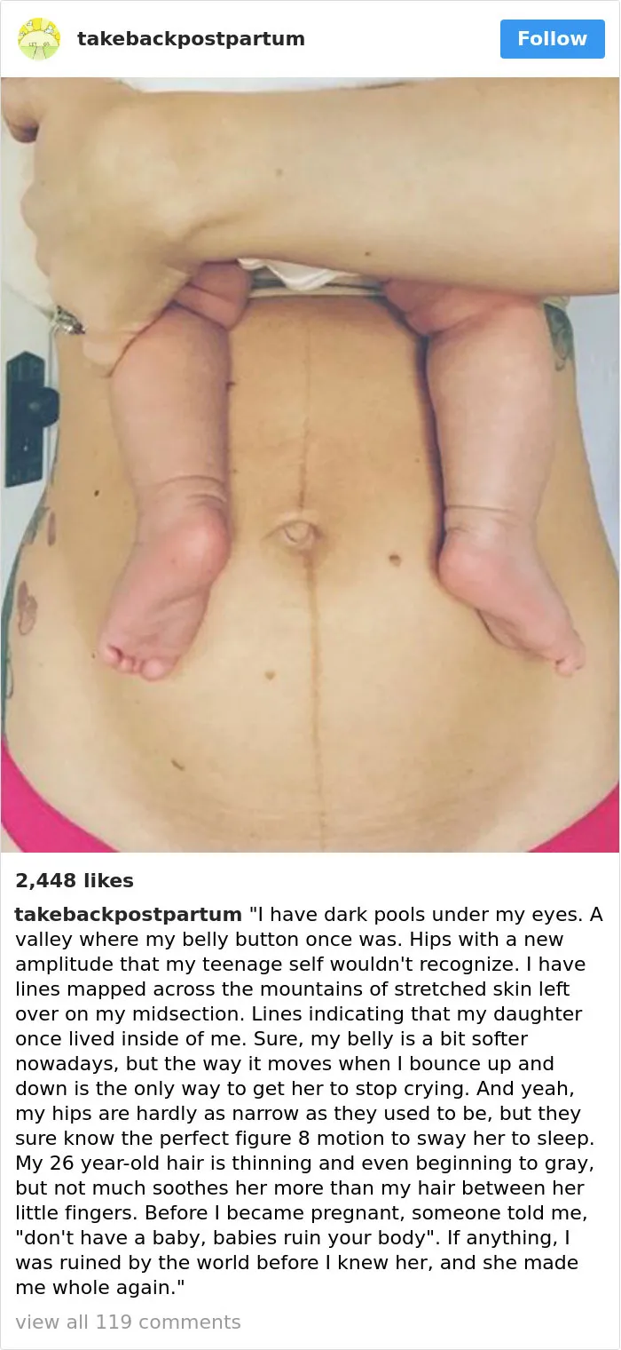 90 Brutally Honest Photos Of Post-Baby Bodies, That Women Are Sharing To Reveal The Truth No One Talks About