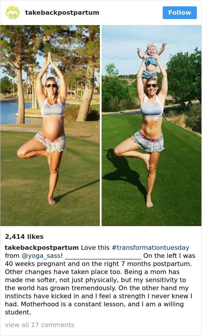 90 Brutally Honest Photos Of Post-Baby Bodies, That Women Are Sharing To Reveal The Truth No One Talks About