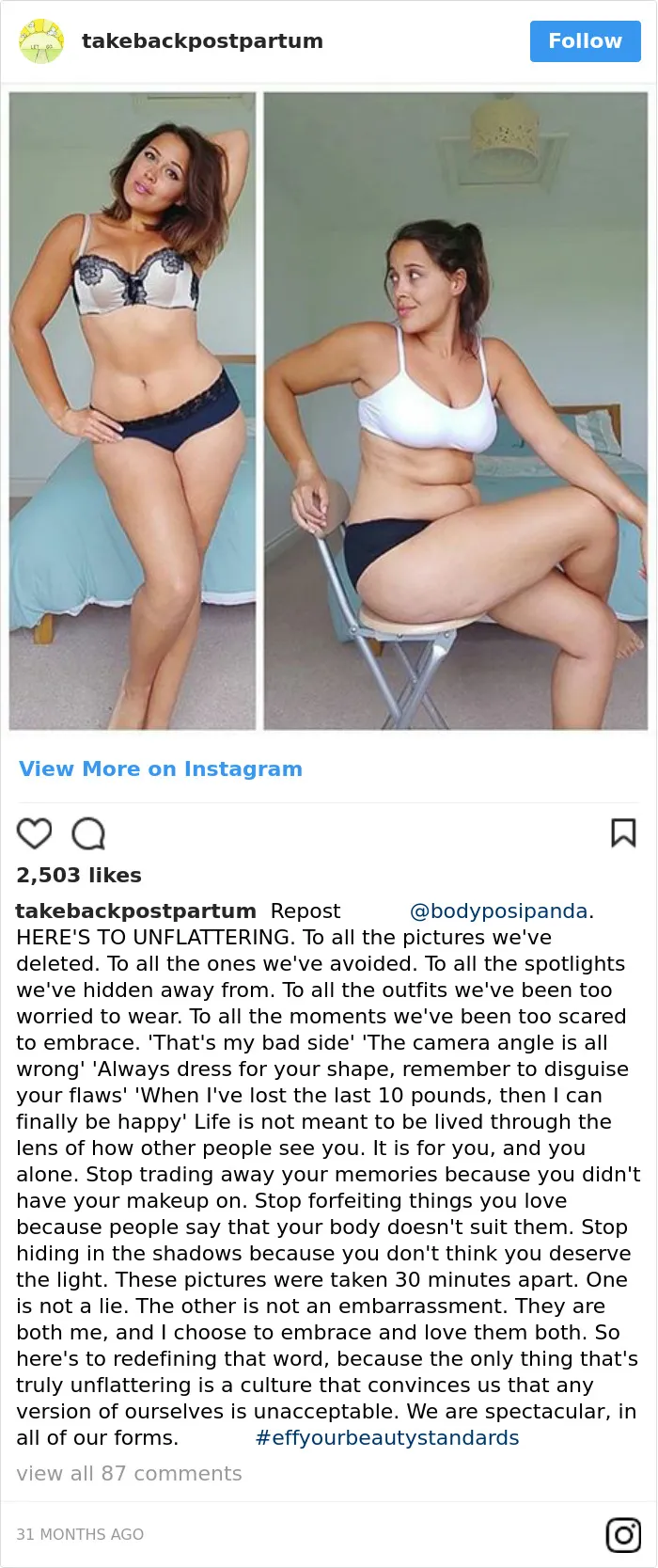 90 Brutally Honest Photos Of Post-Baby Bodies, That Women Are Sharing To Reveal The Truth No One Talks About