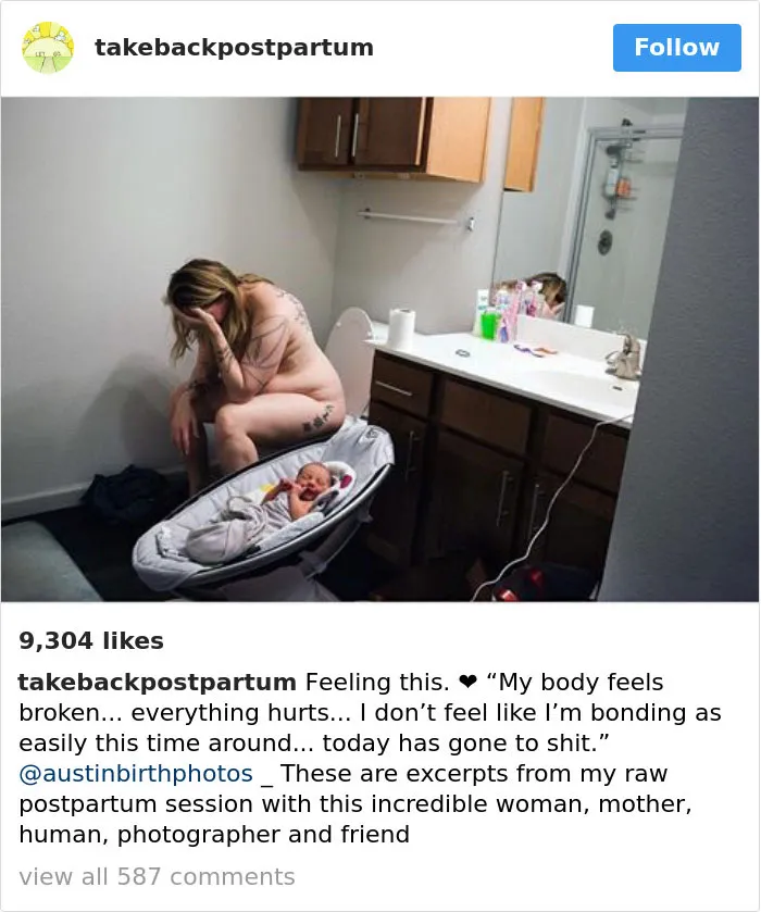 90 Brutally Honest Photos Of Post-Baby Bodies, That Women Are Sharing To Reveal The Truth No One Talks About