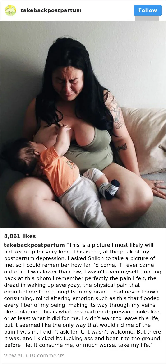 90 Brutally Honest Photos Of Post-Baby Bodies, That Women Are Sharing To Reveal The Truth No One Talks About