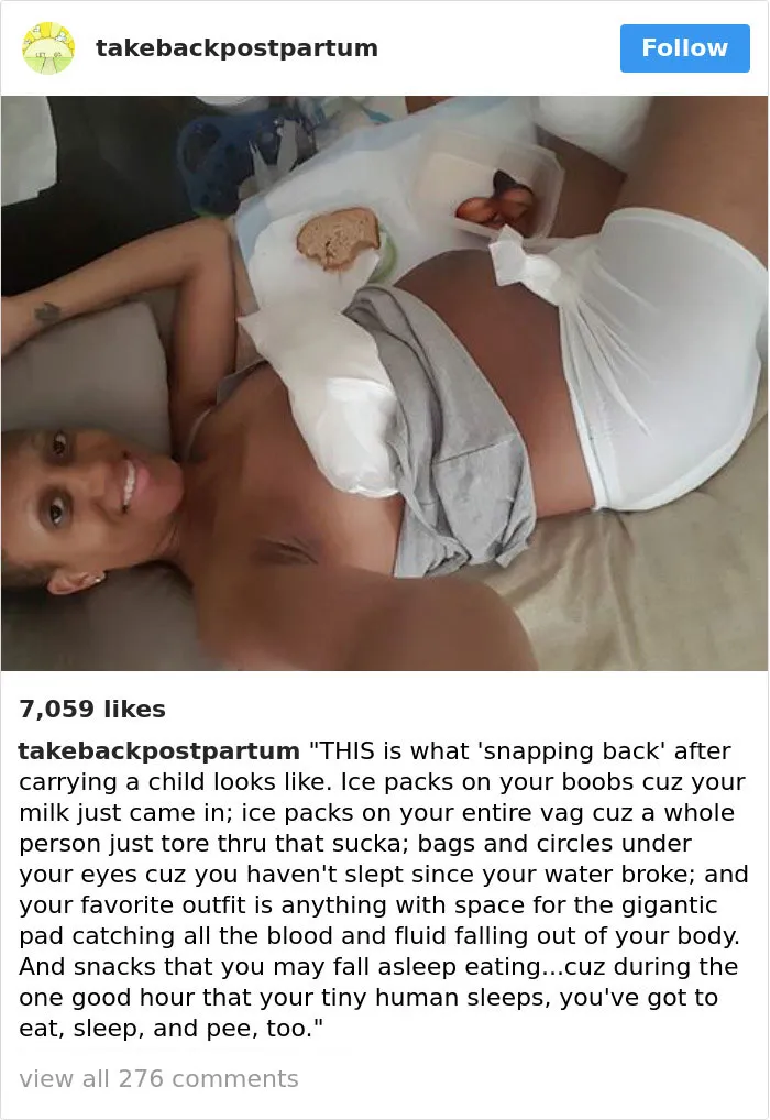 90 Brutally Honest Photos Of Post-Baby Bodies, That Women Are Sharing To Reveal The Truth No One Talks About