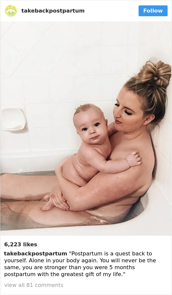 90 Brutally Honest Photos Of Post-Baby Bodies, That Women Are Sharing To Reveal The Truth No One Talks About