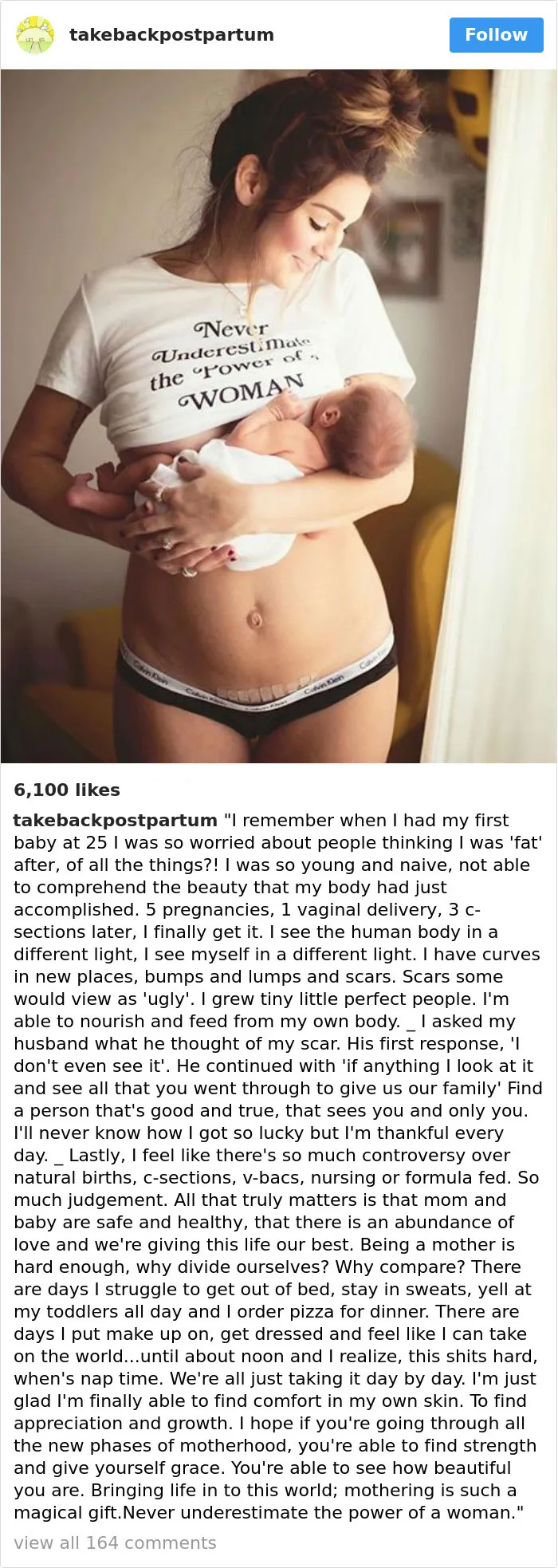 90 Brutally Honest Photos Of Post-Baby Bodies, That Women Are Sharing To Reveal The Truth No One Talks About