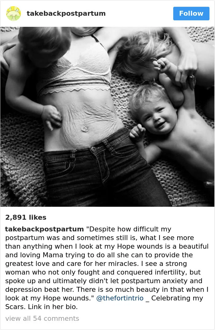 90 Brutally Honest Photos Of Post-Baby Bodies, That Women Are Sharing To Reveal The Truth No One Talks About