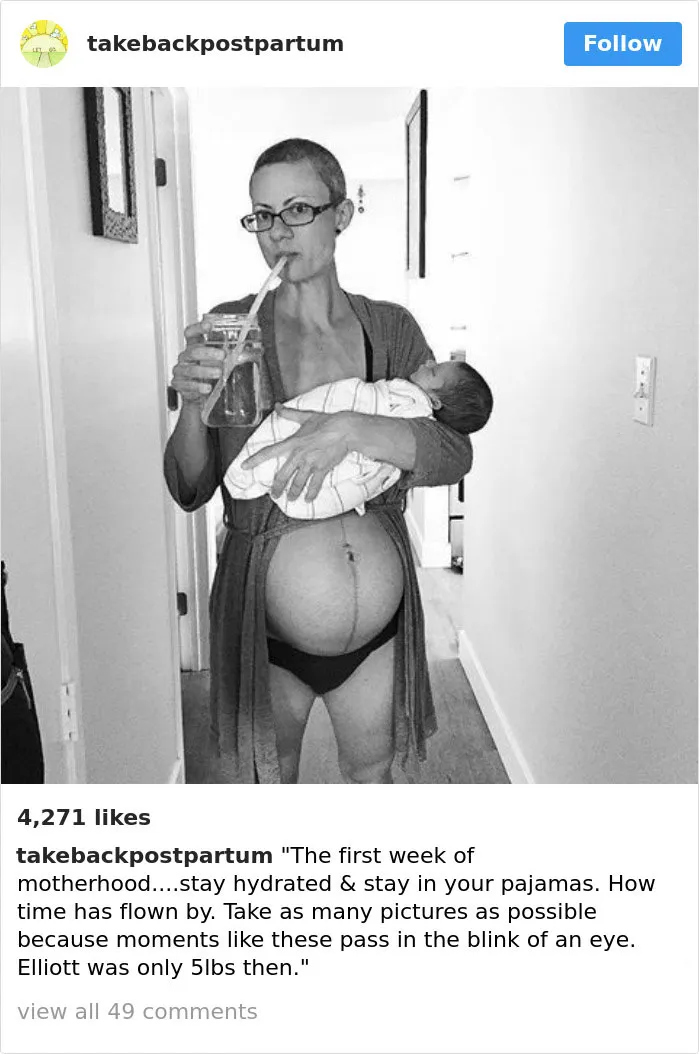 90 Brutally Honest Photos Of Post-Baby Bodies, That Women Are Sharing To Reveal The Truth No One Talks About