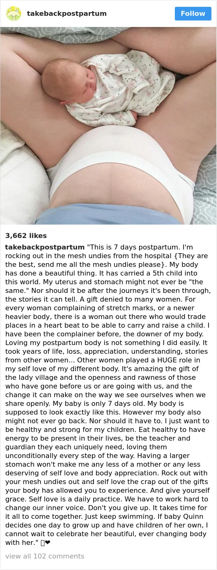 90 Brutally Honest Photos Of Post-Baby Bodies, That Women Are Sharing To Reveal The Truth No One Talks About