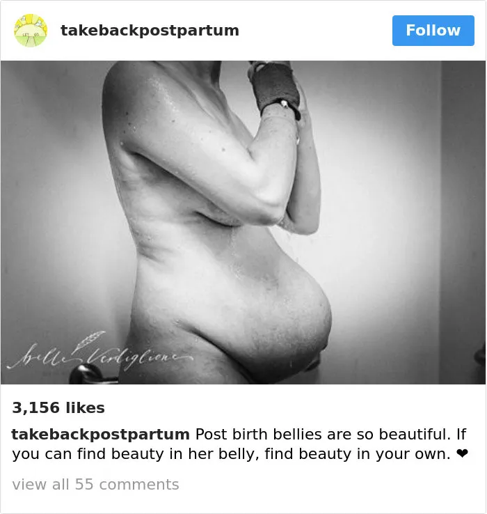 90 Brutally Honest Photos Of Post-Baby Bodies, That Women Are Sharing To Reveal The Truth No One Talks About