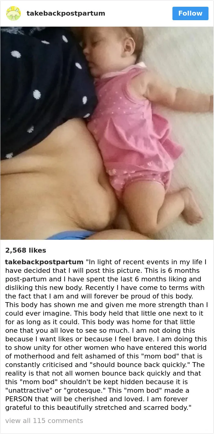 90 Brutally Honest Photos Of Post-Baby Bodies, That Women Are Sharing To Reveal The Truth No One Talks About