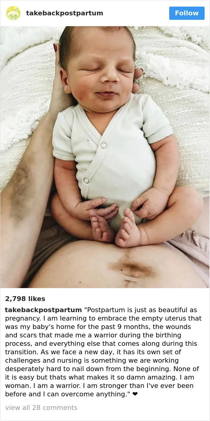 90 Brutally Honest Photos Of Post-Baby Bodies, That Women Are Sharing To Reveal The Truth No One Talks About