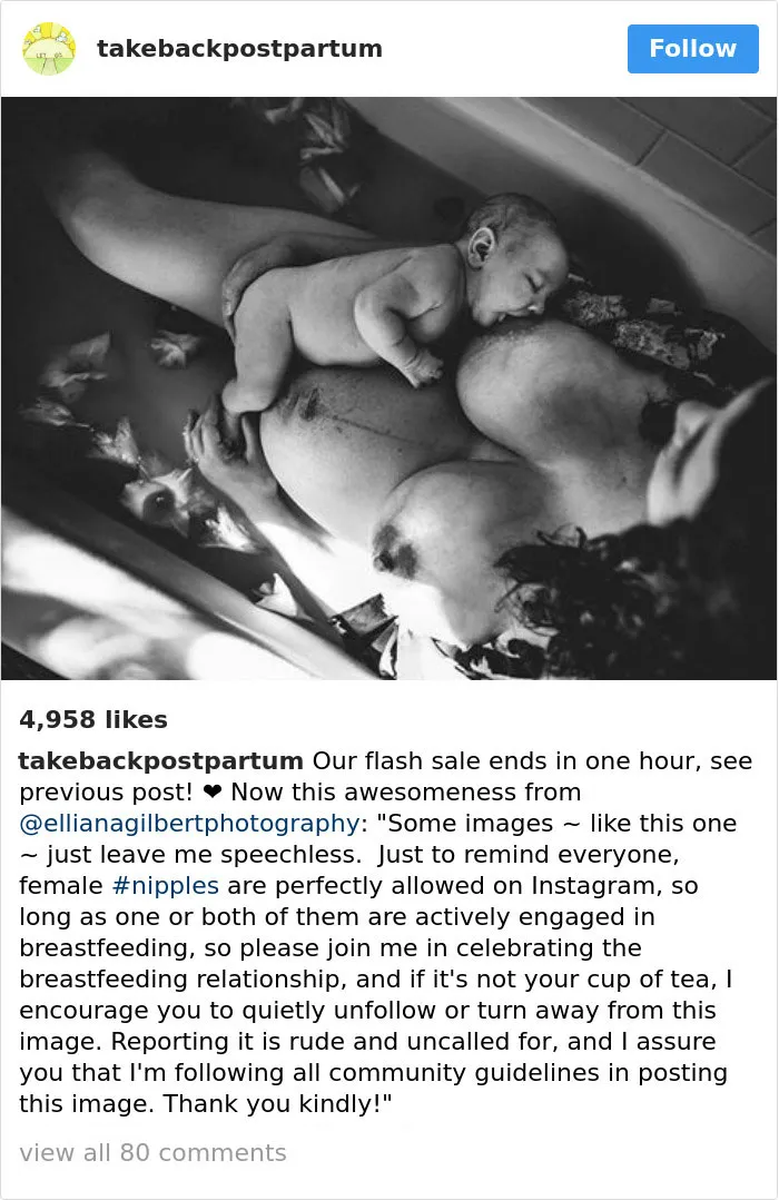 90 Brutally Honest Photos Of Post-Baby Bodies, That Women Are Sharing To Reveal The Truth No One Talks About