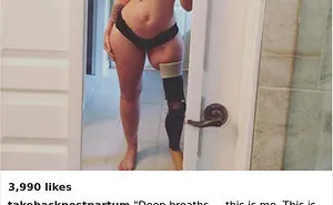 90 Brutally Honest Photos Of Post-Baby Bodies, That Women Are Sharing To Reveal The Truth No One Talks About