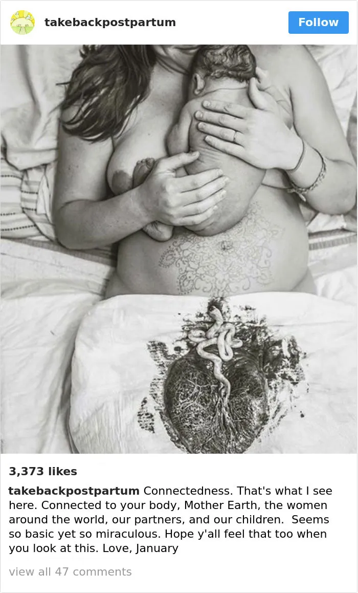 90 Brutally Honest Photos Of Post-Baby Bodies, That Women Are Sharing To Reveal The Truth No One Talks About