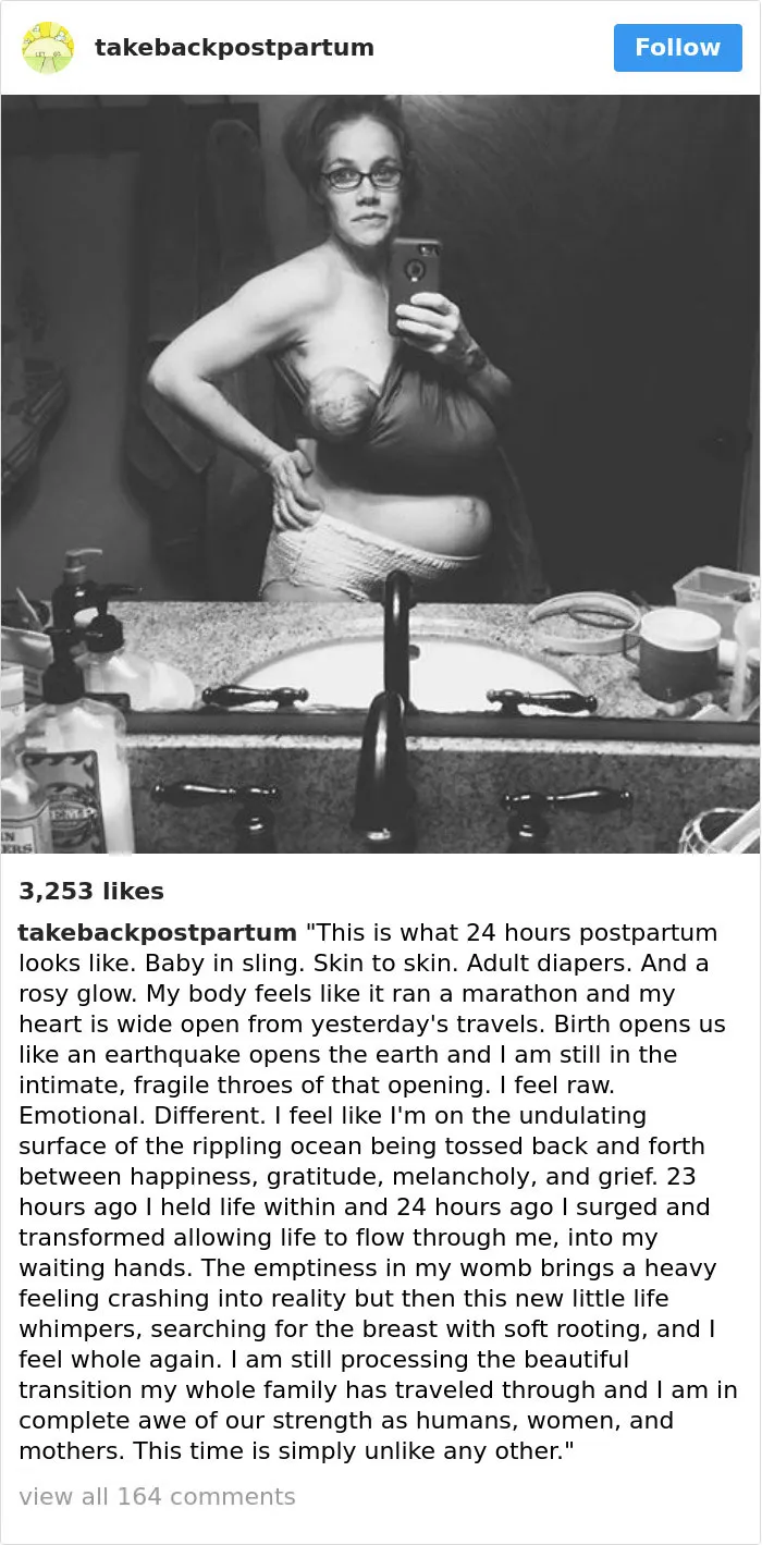 90 Brutally Honest Photos Of Post-Baby Bodies, That Women Are Sharing To Reveal The Truth No One Talks About