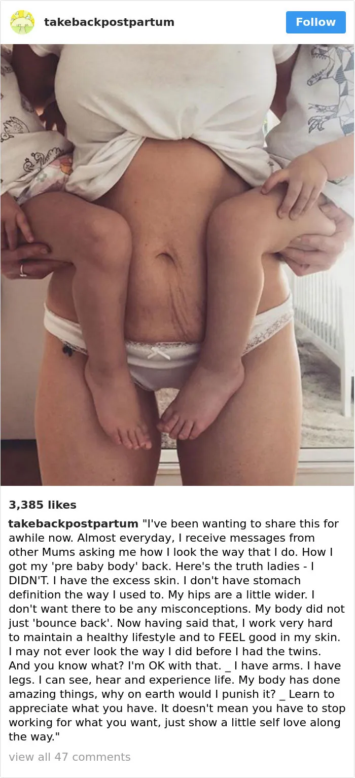 90 Brutally Honest Photos Of Post-Baby Bodies, That Women Are Sharing To Reveal The Truth No One Talks About