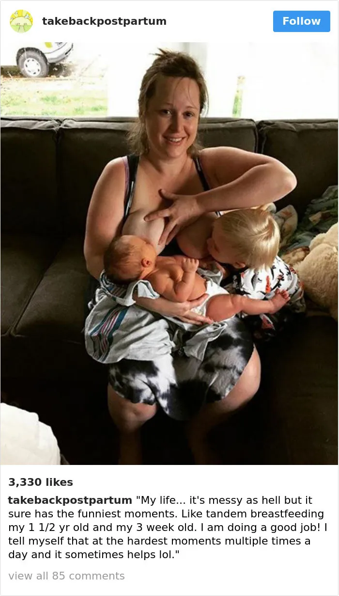 90 Brutally Honest Photos Of Post-Baby Bodies, That Women Are Sharing To Reveal The Truth No One Talks About