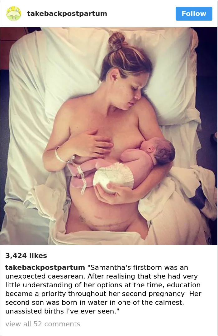 90 Brutally Honest Photos Of Post-Baby Bodies, That Women Are Sharing To Reveal The Truth No One Talks About