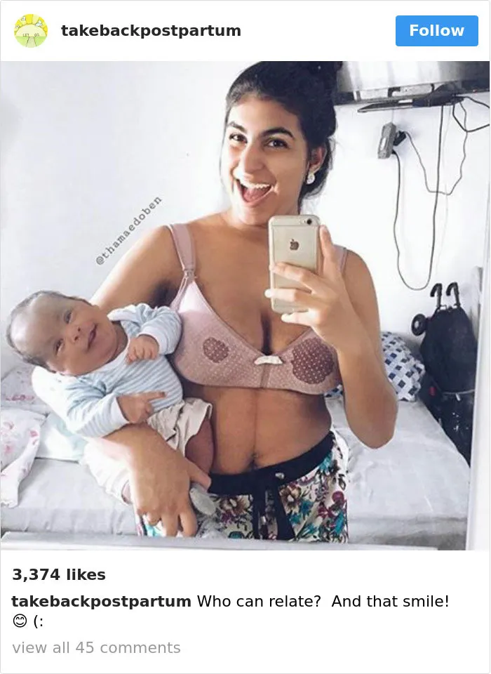 90 Brutally Honest Photos Of Post-Baby Bodies, That Women Are Sharing To Reveal The Truth No One Talks About