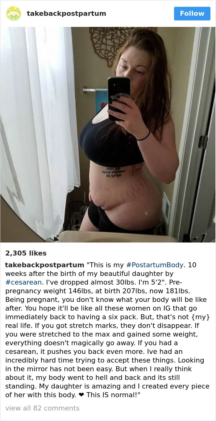 90 Brutally Honest Photos Of Post-Baby Bodies, That Women Are Sharing To Reveal The Truth No One Talks About