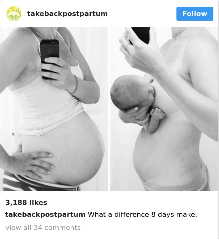 90 Brutally Honest Photos Of Post-Baby Bodies, That Women Are Sharing To Reveal The Truth No One Talks About