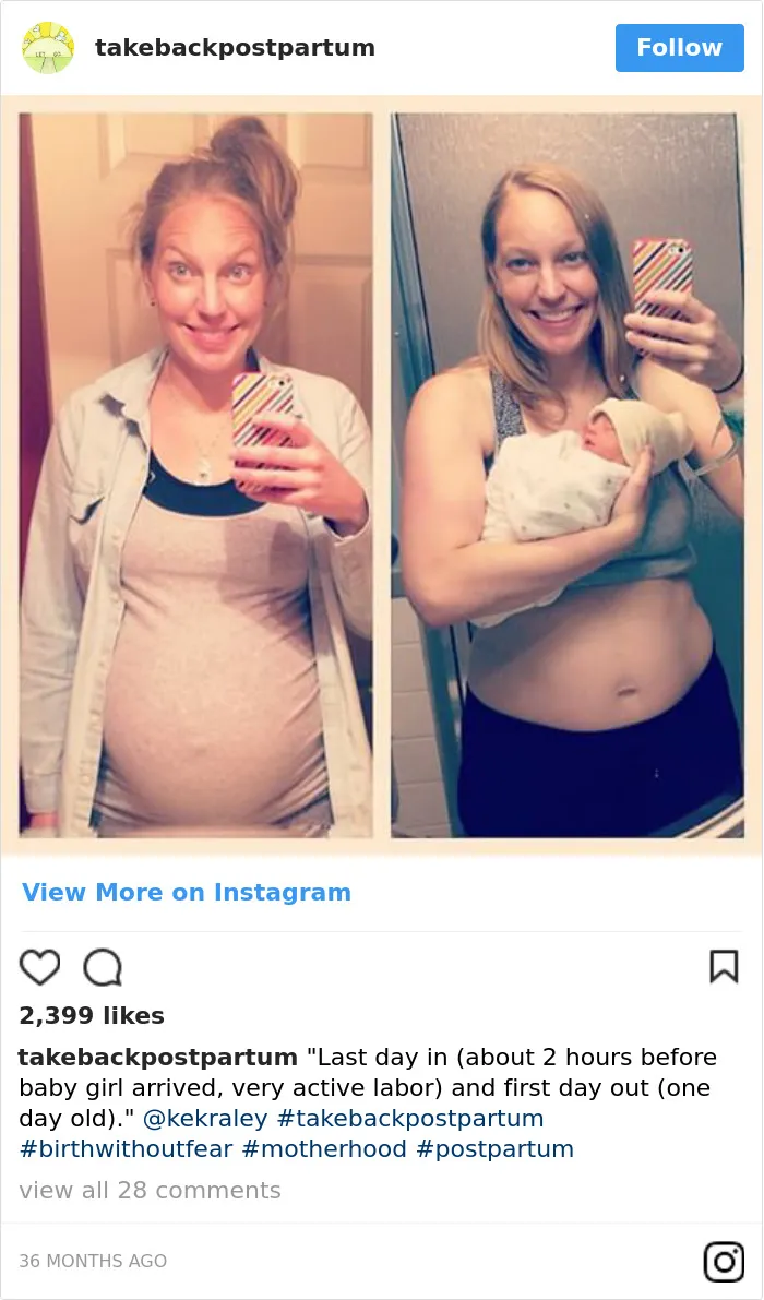 90 Brutally Honest Photos Of Post-Baby Bodies, That Women Are Sharing To Reveal The Truth No One Talks About